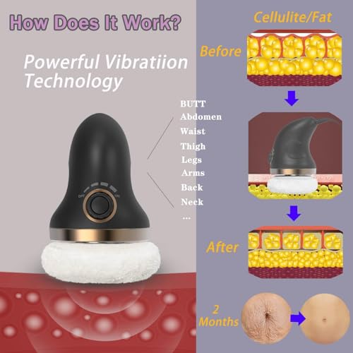 Handheld Cellulite Massager with Lymphatic Drainage D735