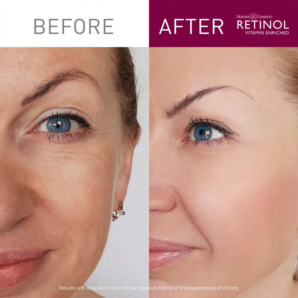Retinol 6X Super Retinol Serum P4033